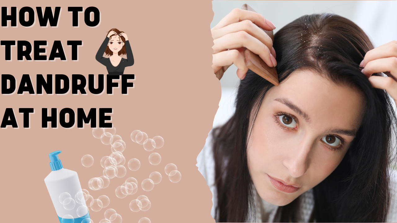 How to Treat Dandruff at Home